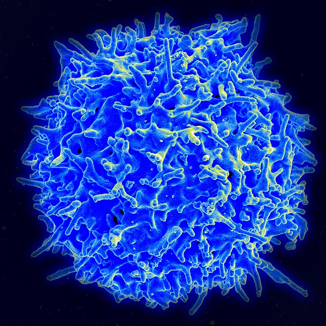 WIKIMEDIA COMMONS | Researchers in professor Alejandro Villagra’s lab are continuing novel research into the role of age-related changes in the biology of certain immune cells and their effects on cancer growth. 