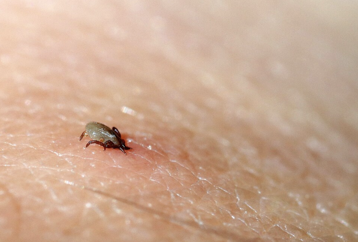 Wikimedia Commons | A recent health education program seeks to inform the local community about ticks in the DMV area that can transmit Lyme disease.